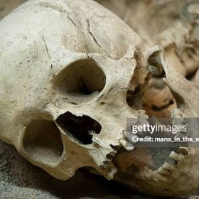 skull